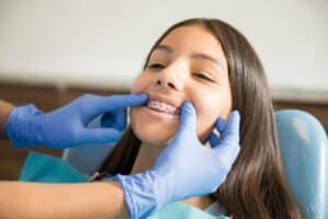 overbite treatment for teen girl