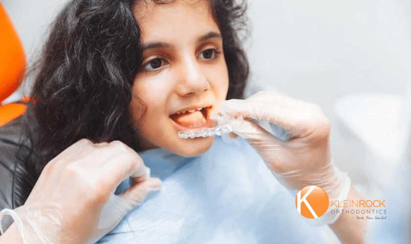 How-Does-Invisalign-Works-For-Teen