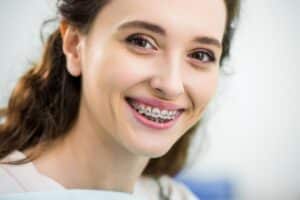 beautiful women smiling with dental braces