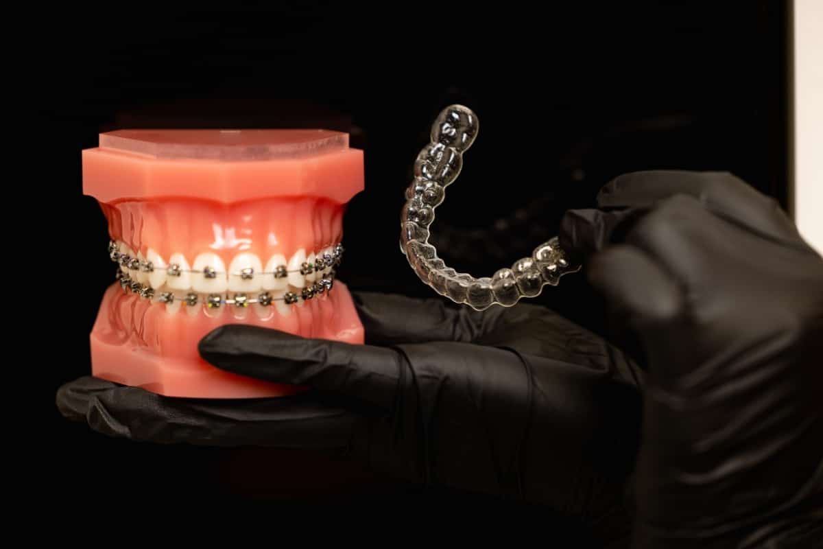 can you smoke vape with invisalign Class One Orthodontics main image 0