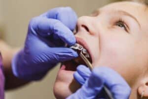 Extended Braces for Kids