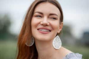 Young woman with metal braces smiling outdoors, showing proper dental care results.