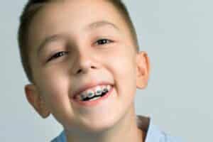 Young boy smiling with metal braces, showing successful orthodontic treatment for children.